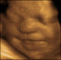 Unborn baby smiling in the uterus